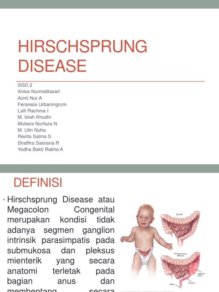 Qalamdagi chochqa bilan jinsiy aloqa