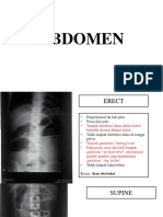 Ileus obstruksi dan pneumoperitoneum pada abdomen CT scan