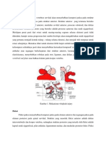 Risa - Patofisiologi Whiplash Injury