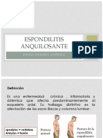 Espondilitis Anquilosante