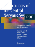 Tuberculosis of The Central Nervous System-Pathogenesis, Imaging, and Management