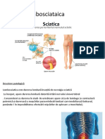 L Ombo Sciatica