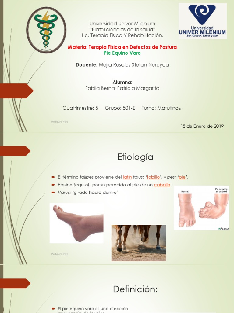 Pie Equino Varo PDF Pie Sistema musculoesquelético