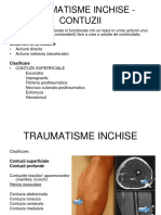 Traumatisme Inchise - Contuzii