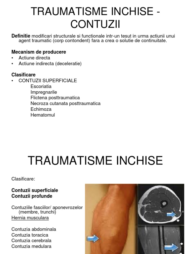 Traumatisme Inchise - Contuzii | PDF