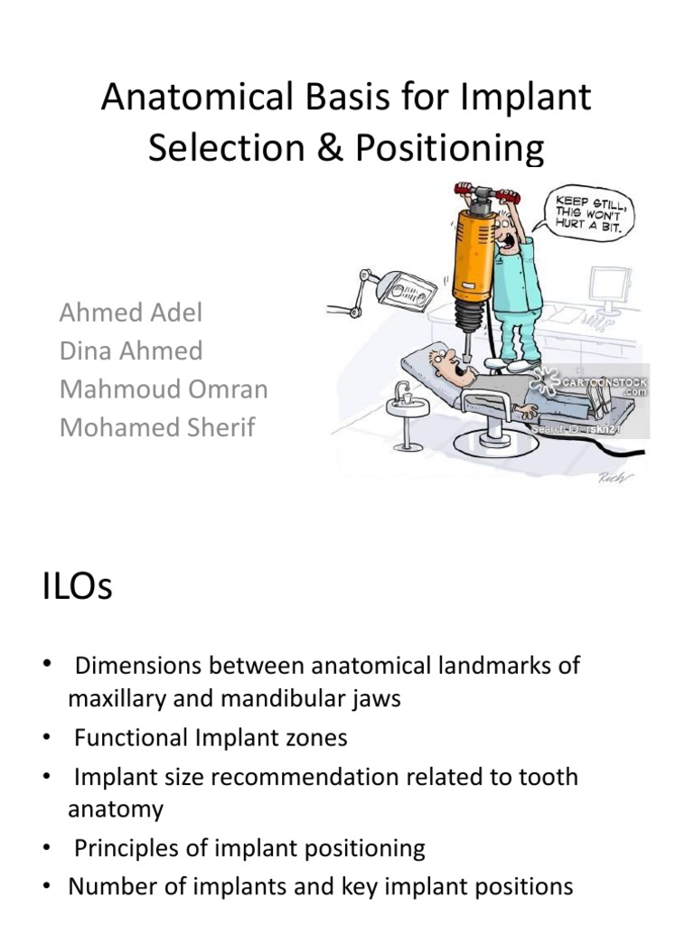 Anatomical Considerations for Implant Placement | PDF | Dental Implant ...