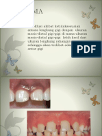 Diastema