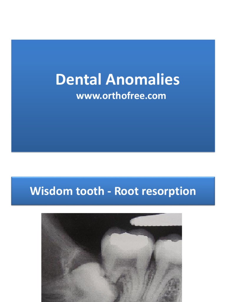4 Dental Anomaly PDF Human Tooth Facial Features