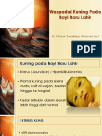 Waspadai Kuning Pada BAYI