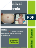 Everything You Need to Know About Umbilical Hernias