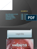 Vaginisitis