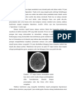 CT Scan Tanpa Kontras Dapat Mendeteksi Area Iskemik Pada Otak Dalam Waktu 3