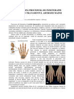 Osteoartrita mainilor