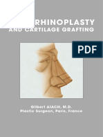 Open Rhinoplasty: and Cartilage Grafting