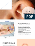 Fistula Preaurikula