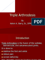 57753197-Triple-Arthrodesis.ppt