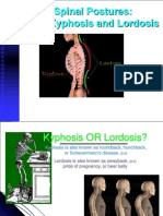 Abnormal Spinal Postures Kyphosis and Lordosis