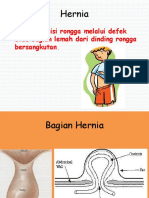 209111080-Hernia-Ppt.ppt