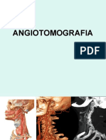 angio tomografia
