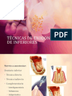 Ttécnicas de Exodoncia de Inferiores