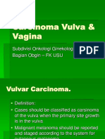 CA VULVA DR DE