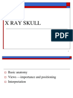 SKull X Ray