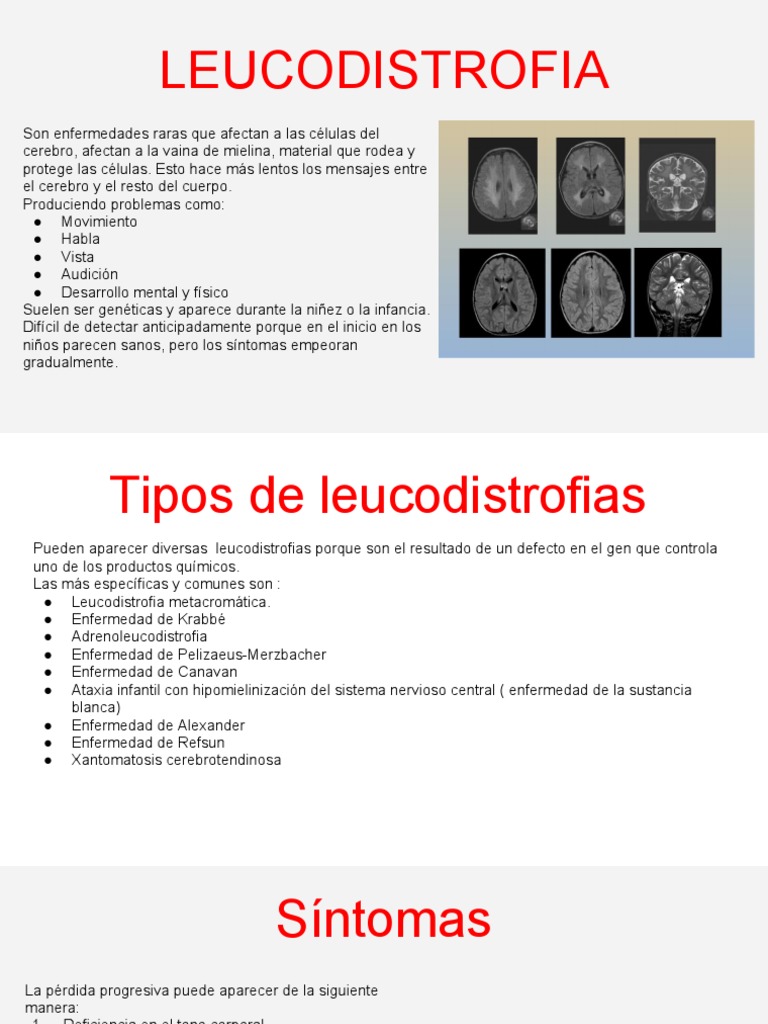 tipos-y-s-ntomas-de-leucodistrofias-pdf-terapia-de-genes