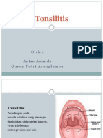 Tonsilitis