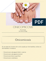 Onicomicosis 