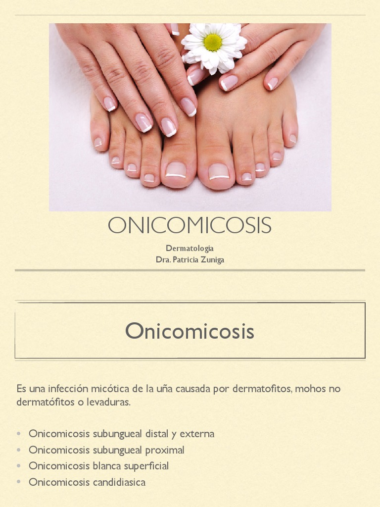 Onicomicosis y Candidiasis: Diagnóstico y Tratamiento | PDF ...