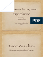 Neoplasias Benignas e Hiperplasias