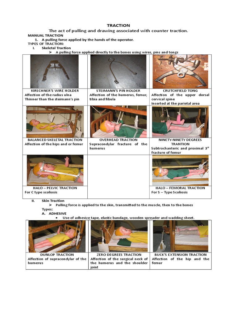 A Comprehensive Guide to Balanced Skeletal Traction Indications