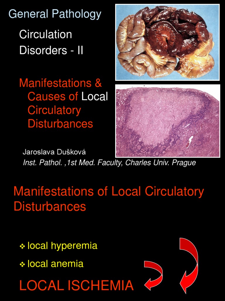 Circulation Disorders - II: General Pathology | PDF | Thrombosis | Platelet