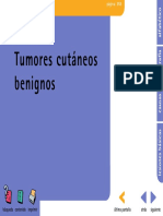 Tumores de Benignos de Piel