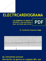 ELECTROCARDIOGRAMAS fotos.pdf
