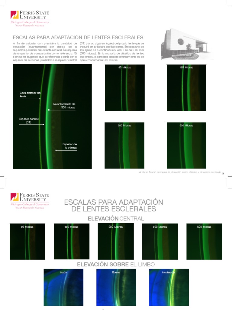 Scleral Lens Fit Scales Espanol