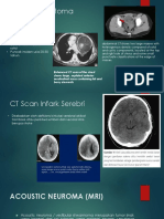 TERATOMA CT SCAN