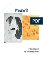 Pneumonia PDF