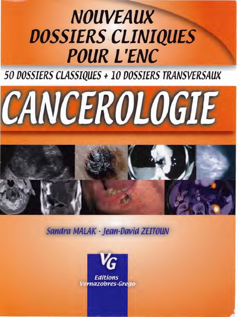 Loxen 50 Agit En Combien De Temps Cancerologie CC VG - Text | PDF | Oncogène | Cancer