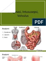 TL Intususepsi