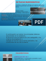 Interpretación de Placas Radiograficas PDF