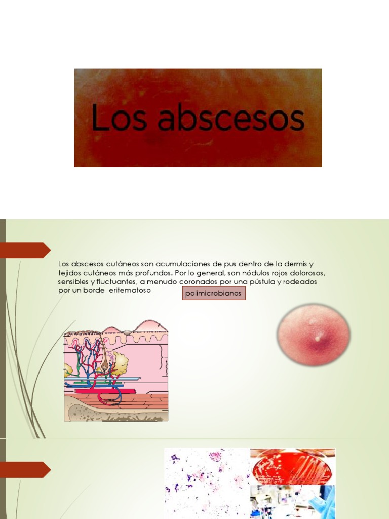Manejo de abscesos y celulitis cutáneos | PDF | Rtt | Medicina