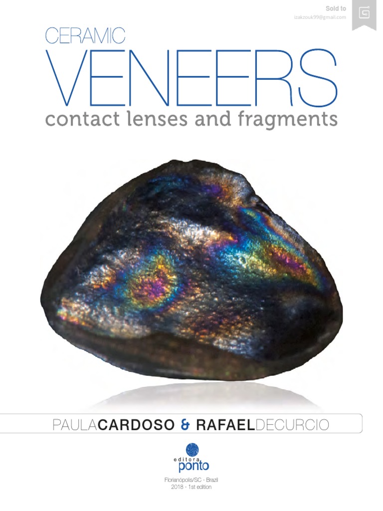 Ceramic Veneers Contact Lenses and Fragments PDF Beauty