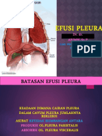 Revisi-Efusi Pleura Fkuwks 2017