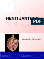 Henti Jantung