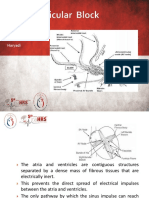 Atrioventricular Block