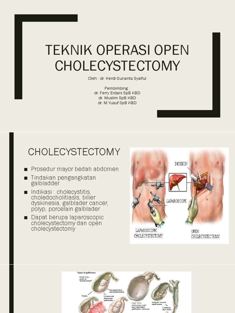 Teknik Open Cholecystectomy Terperinci | PDF