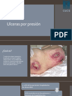 Ulceras Por Presión