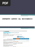 Infarto Agudo de Miocardio