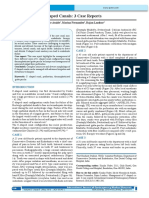 Management of C Shaped Canals: 3 Case Reports